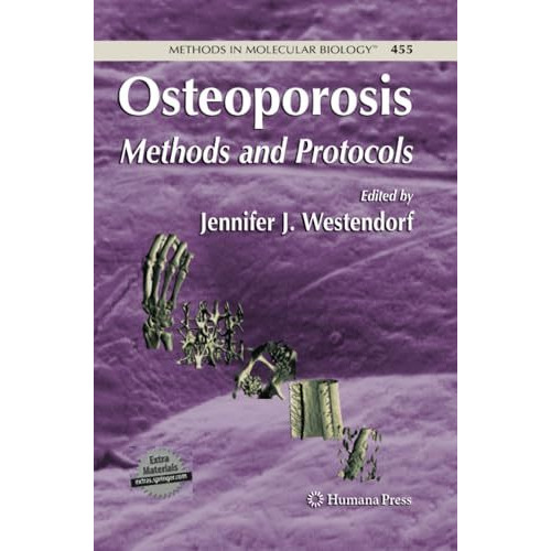 Osteoporosis: Methods and Protocols [Paperback]