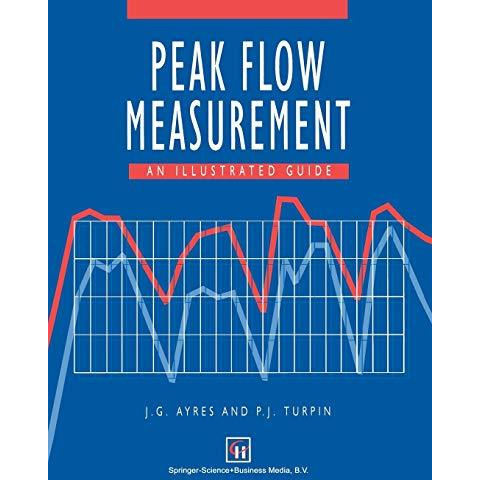 Peak Flow Measurement: An Illustrated Guide [Paperback]