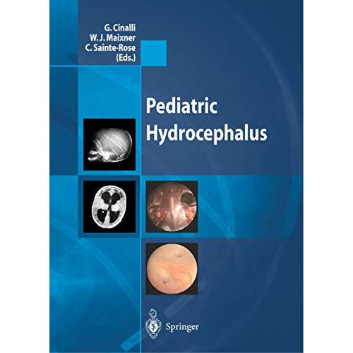 Pediatric Hydrocephalus [Paperback]