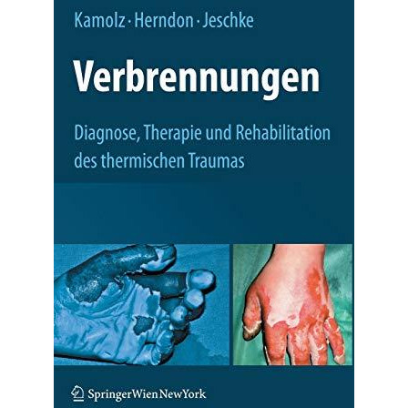 Verbrennungen: Diagnose, Therapie und Rehabilitation des thermischen Traumas [Hardcover]