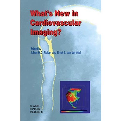 Whats New in Cardiovascular Imaging? [Paperback]