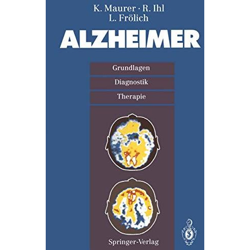 Alzheimer: Grundlagen, Diganostik, Therapie [Paperback]