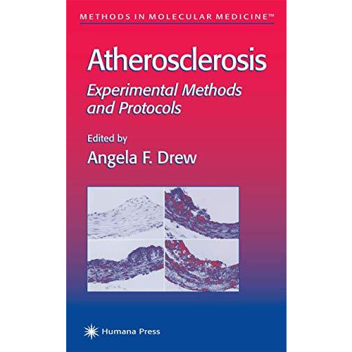 Atherosclerosis: Experimental Methods and Protocols [Hardcover]