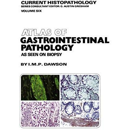 Atlas of Gastrointestinal Pathology: As Seen on Biopsy [Paperback]