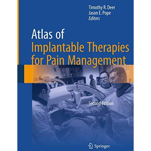 Atlas of Implantable Therapies for Pain Management [Paperback]