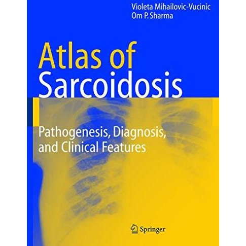 Atlas of Sarcoidosis: Pathogenesis, Diagnosis and Clinical Features [Paperback]