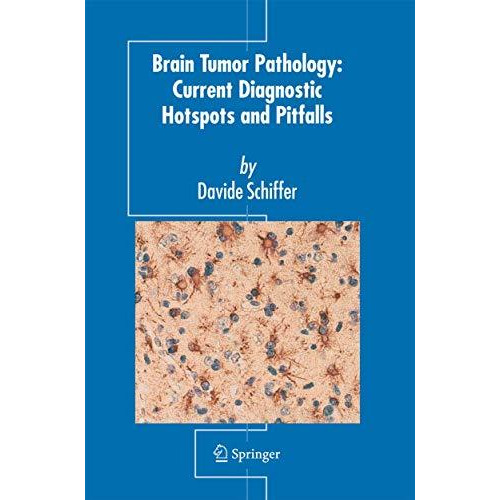 Brain Tumor Pathology: Current Diagnostic Hotspots and Pitfalls [Paperback]