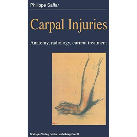 Carpal injuries: Anatomy, radiology, current treatment [Paperback]