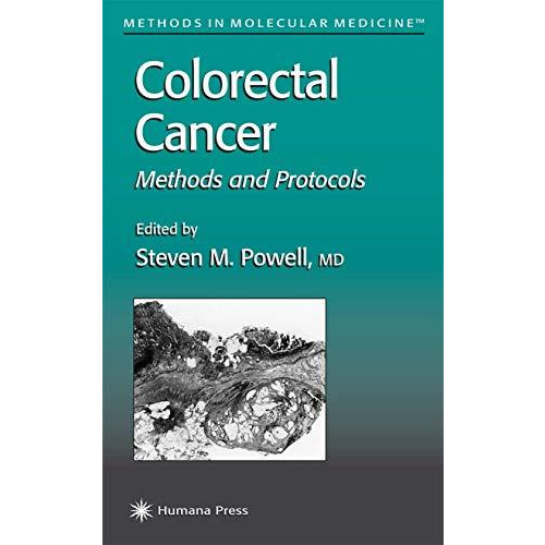 Colorectal Cancer: Methods and Protocols [Hardcover]