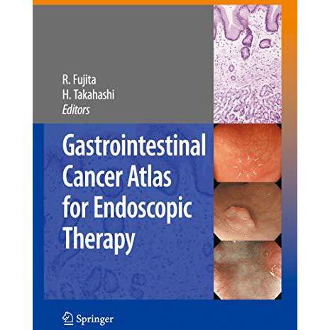 Gastrointestinal Cancer Atlas for Endoscopic Therapy [Paperback]