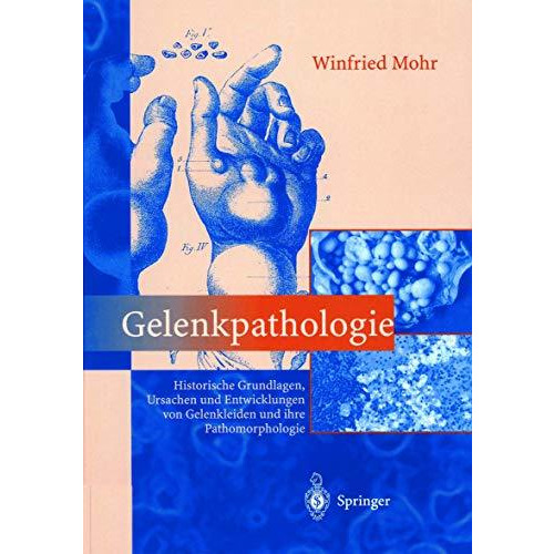 Gelenkpathologie: Historische Grundlagen, Ursachen und Entwicklungen von Gelenkl [Paperback]