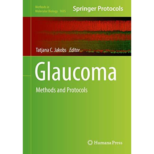 Glaucoma: Methods and Protocols [Hardcover]