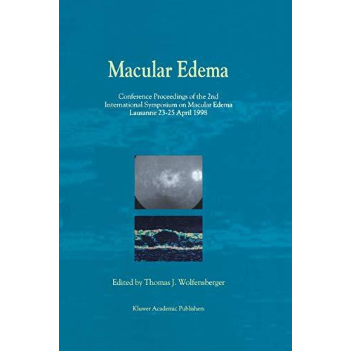 Macular Edema: Conference Proceedings of the 2nd International Symposium on Macu [Paperback]