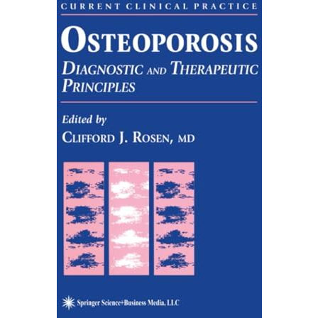 Osteoporosis: Diagnostic and Therapeutic Principles [Paperback]