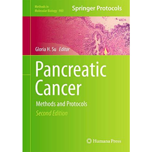 Pancreatic Cancer: Methods and Protocols [Hardcover]