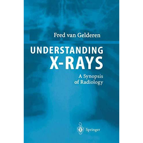 Understanding X-Rays: A Synopsis of Radiology [Hardcover]