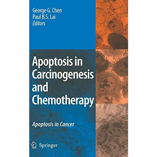 Apoptosis in Carcinogenesis and Chemotherapy: Apoptosis in cancer [Hardcover]