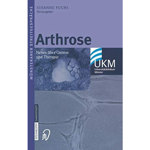 Arthrose: Neues ?ber Genese und Therapie [Paperback]