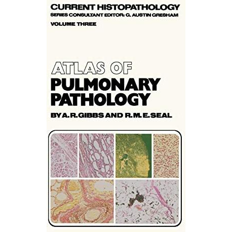 Atlas of Pulmonary Pathology [Hardcover]