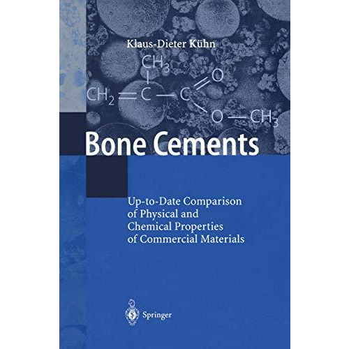 Bone Cements: Up-to-Date Comparison of Physical and Chemical Properties of Comme [Paperback]