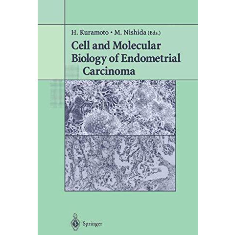 Cell and Molecular Biology of Endometrial Carcinoma [Paperback]