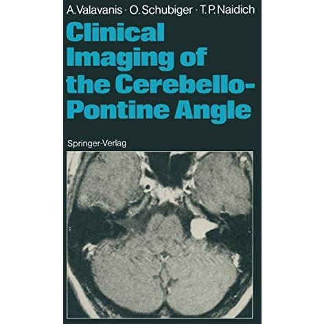 Clinical Imaging of the Cerebello-Pontine Angle [Paperback]