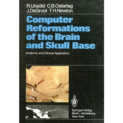 Computer Reformations of the Brain and Skull Base: Anatomy and Clinical Applicat [Paperback]