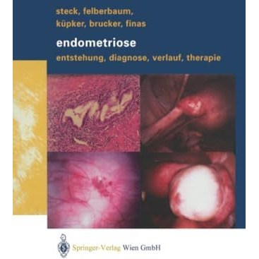 Endometriose: Entstehung, Diagnose, Verlauf und Therapie [Paperback]