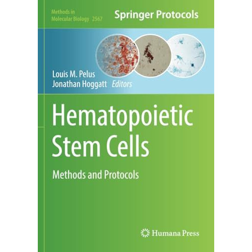 Hematopoietic Stem Cells: Methods and Protocols [Paperback]