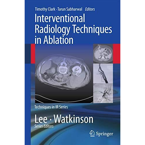 Interventional Radiology Techniques in Ablation [Paperback]