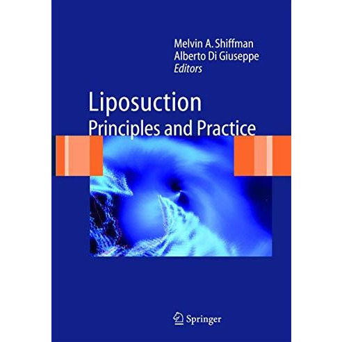 Liposuction: Principles and Practice [Paperback]