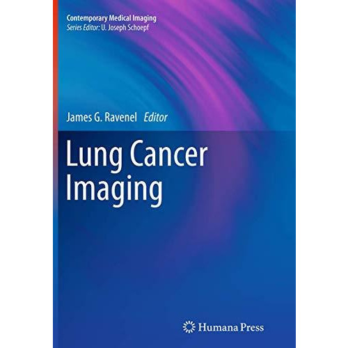 Lung Cancer Imaging [Paperback]