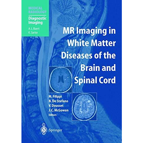 MR Imaging in White Matter Diseases of the Brain and Spinal Cord [Hardcover]