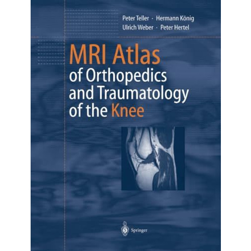 MRI Atlas of Orthopedics and Traumatology of the Knee [Paperback]