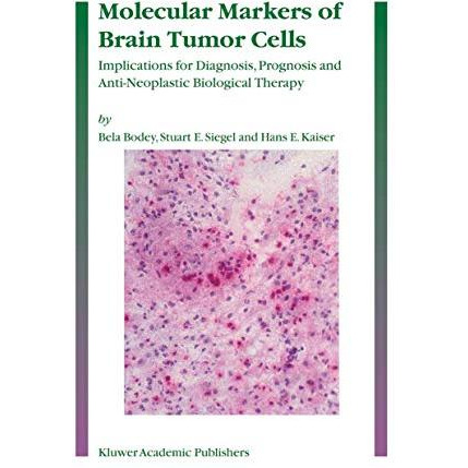 Molecular Markers of Brain Tumor Cells: Implications for Diagnosis, Prognosis an [Hardcover]