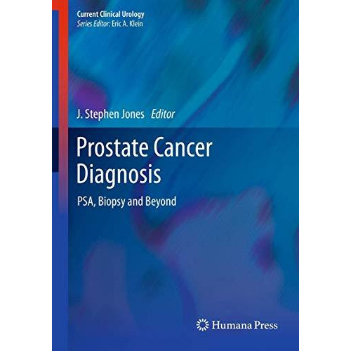 Prostate Cancer Diagnosis: PSA, Biopsy and Beyond [Hardcover]