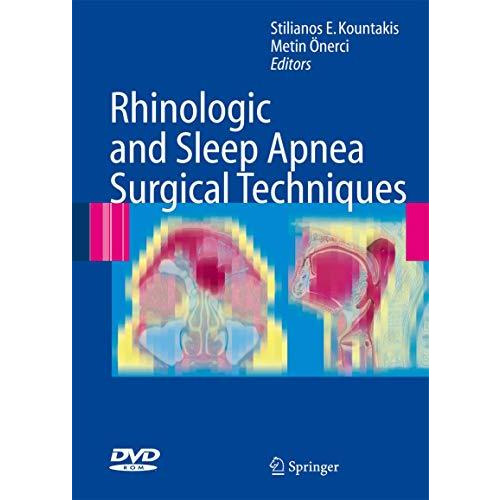 Rhinologic and Sleep Apnea Surgical Techniques [Mixed media product]