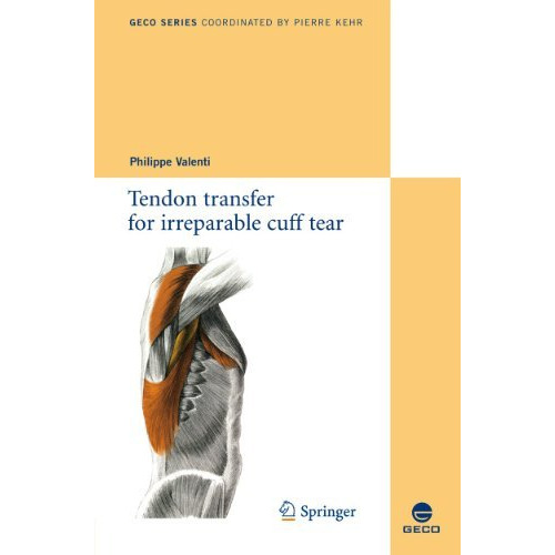 Tendon transfer for irreparable cuff tear [Paperback]