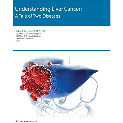 Understanding Liver Cancer: A Tale of Two Diseases [Paperback]