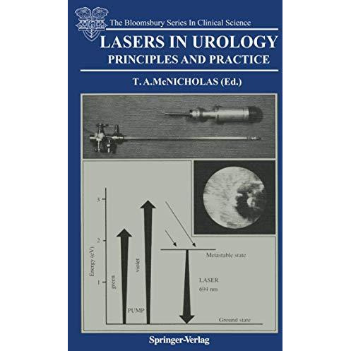 Lasers in Urology: Principles and Practice [Paperback]