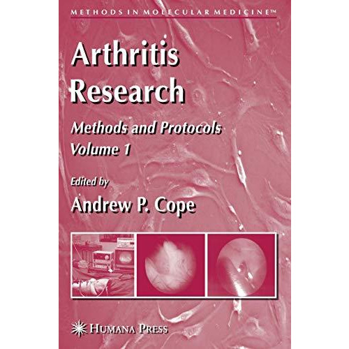 Arthritis Research: Volume 1: Methods and Protocols [Paperback]