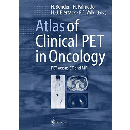 Atlas of Clinical PET in Oncology: PET versus CT and MRI [Paperback]