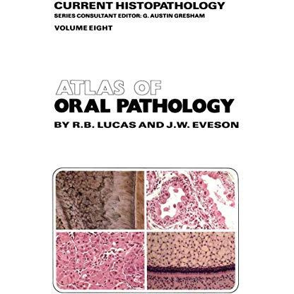 Atlas of Oral Pathology [Paperback]