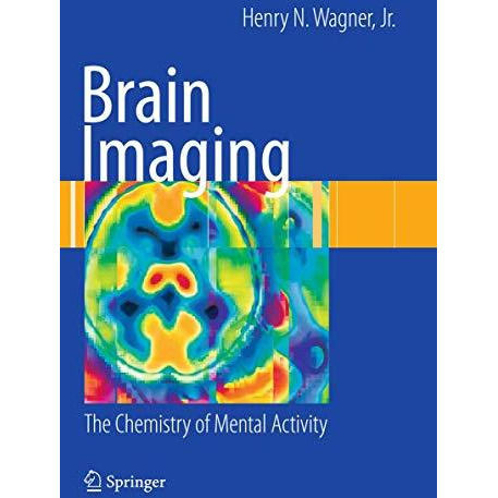 Brain Imaging: The Chemistry of Mental Activity [Paperback]