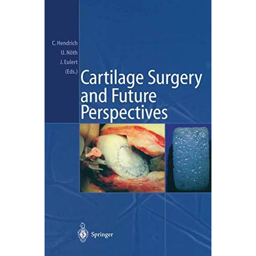 Cartilage Surgery and Future Perspectives [Paperback]