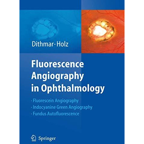 Fluorescence Angiography in Ophthalmology [Hardcover]