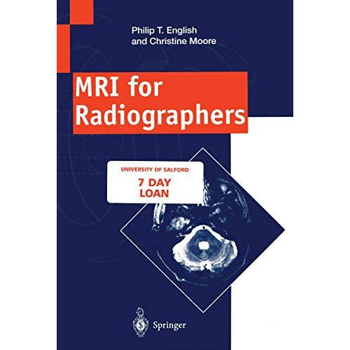 MRI for Radiographers [Paperback]