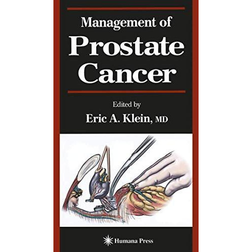 Management of Prostate Cancer [Paperback]