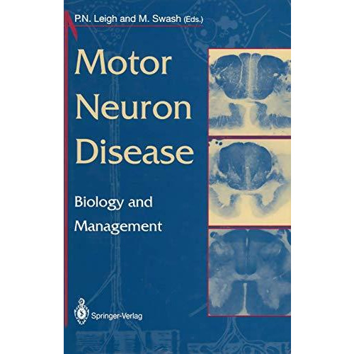 Motor Neuron Disease: Biology and Management [Paperback]