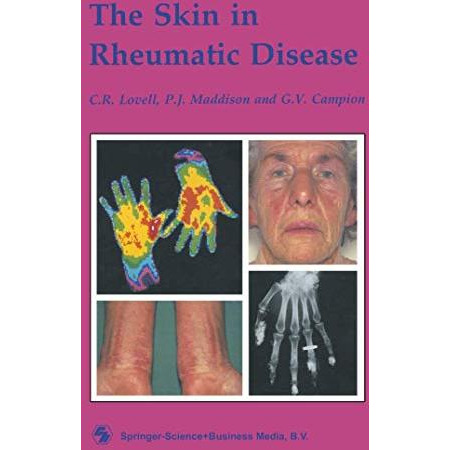 The Skin in Rheumatic Disease [Paperback]